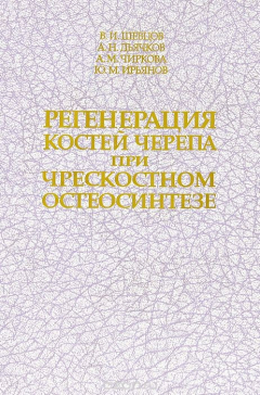 Книга Регенерация костей черепа при чрескостном остеосинтезе на ReadRate.com книга Регенерация костей черепа при чрескостном остеосинтезе
