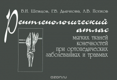 Книга Рентгенологический атлас мягких тканей конечностей при ортопедических заболеваниях и травмах на ReadRate.com книга Рентгенологический атлас мягких тканей конечностей при ортопедических заболеваниях и травмах