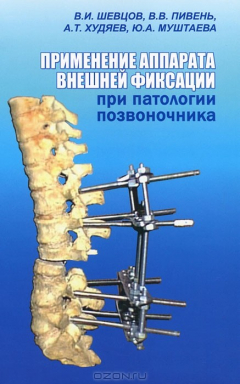 Книга Применение аппарата внешней фиксации при патологии позвоночника на ReadRate.com книга Применение аппарата внешней фиксации при патологии позвоночника